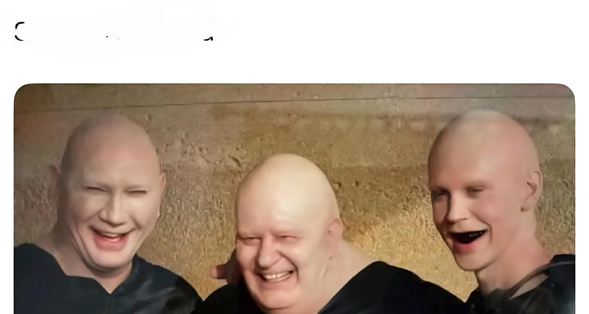 Moi et ma famille on perd un peu nos cheveux, c'est grave ?