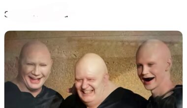 Moi et ma famille on perd un peu nos cheveux, c'est grave ?