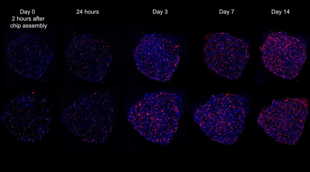 A time lapse image showing microscopic cancer cells forming clusters