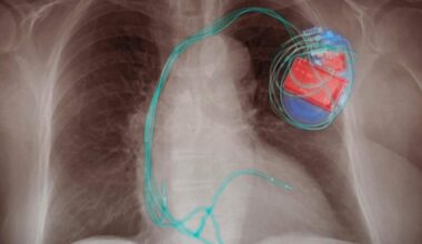 Wie die Parteien auf das Preischaos bei Implantaten reagieren