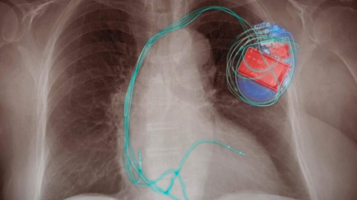 Wie die Parteien auf das Preischaos bei Implantaten reagieren