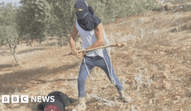 Palestinian woman in hospital after being clubbed by masked Israeli settler