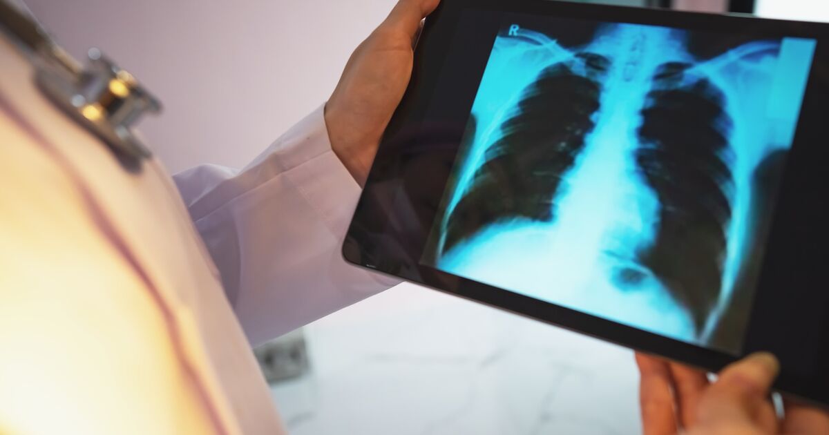 Why COPD is more common in rural areas