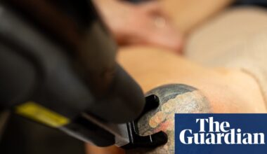 From former Nazis to refugees and DV survivors, tattoo removal is giving Australians a ‘second chance’ | Tattoos