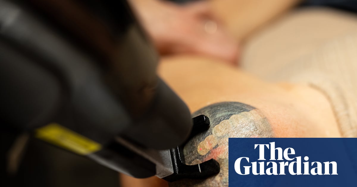 From former Nazis to refugees and DV survivors, tattoo removal is giving Australians a ‘second chance’ | Tattoos