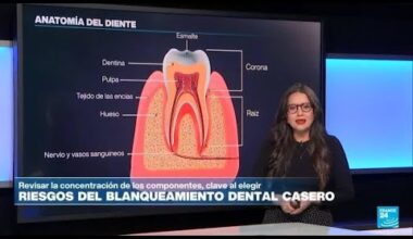 Los riesgos del blanqueamiento dental casero • FRANCE 24 Español