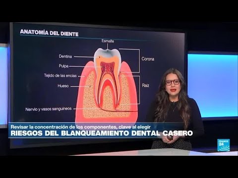 Los riesgos del blanqueamiento dental casero • FRANCE 24 Español