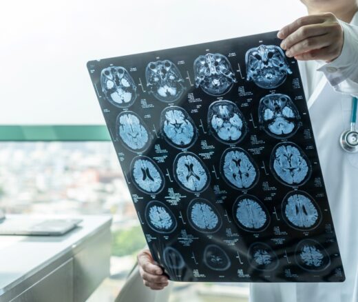 Medical doctor seeing Magnetic Resonance Imaging (MRI) film diagnosing elderly patient.