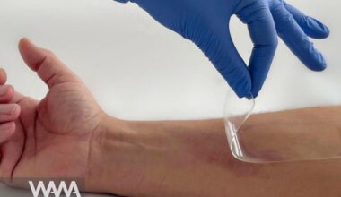 Iran Unveils Amniotic-Based Bio-Dressing for Wound Healing