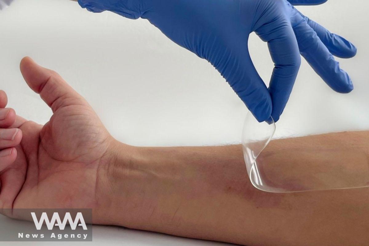 Iran Unveils Amniotic-Based Bio-Dressing for Wound Healing