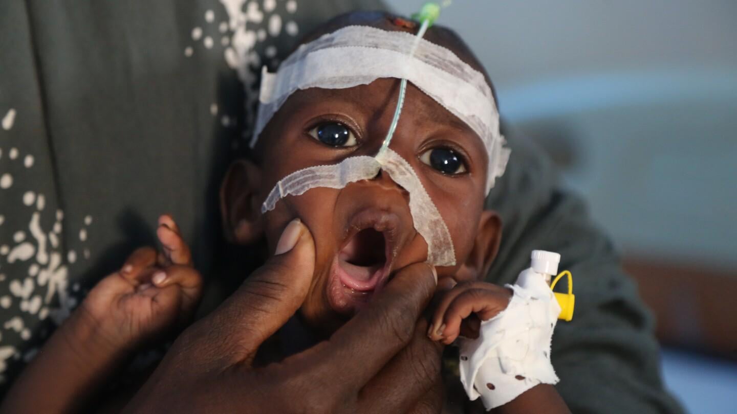 The world turns a blind eye as war-torn Somalia’s hospitals crumble