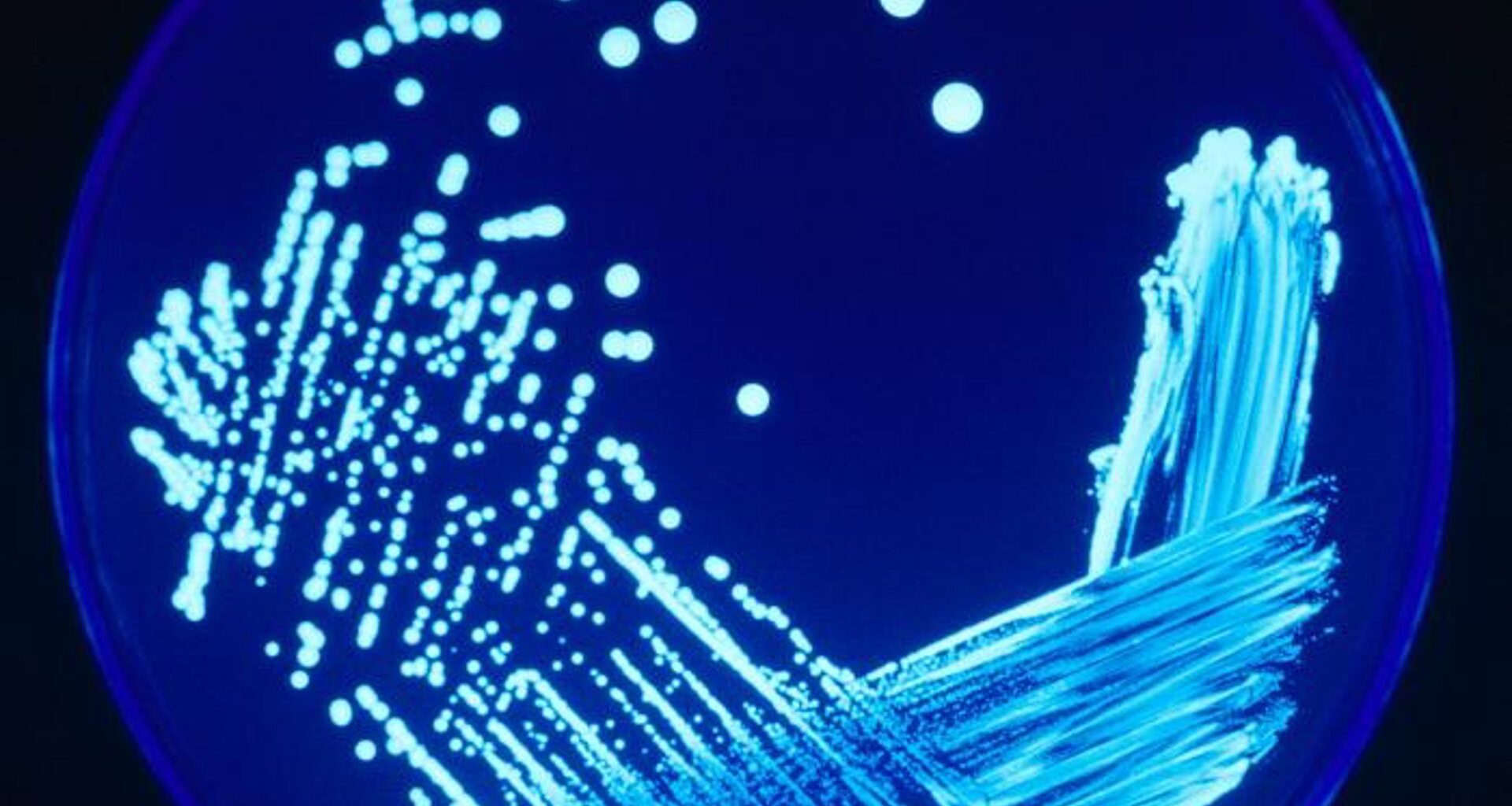 Incremento preocupante del 13% en los casos de legionelosis en España este año