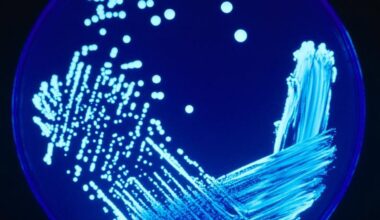 Incremento preocupante del 13% en los casos de legionelosis en España este año