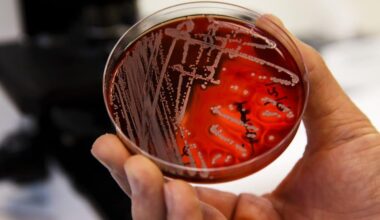 Forskare: Snart fungerar inga antibiotika längre