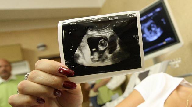 Má Česko zakázat náhradní mateřství, jak to udělali Slováci? Hlasujte, pište