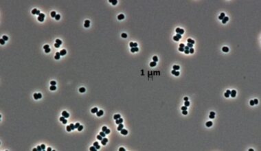 Bacteria That "Play Dead" May Have Been Accidentally Sent Into Space