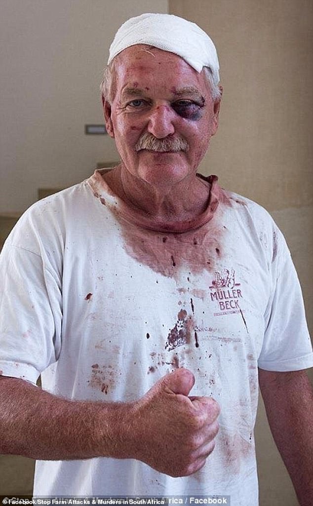 Pictures posted to the Stop Farm Attacks & Murders in South Africa Facebook page show the horrific injuries inflicted on farmers