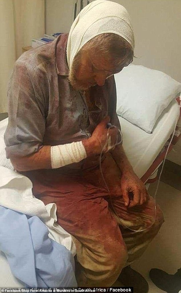 A man appears bloodied in a hospital bed