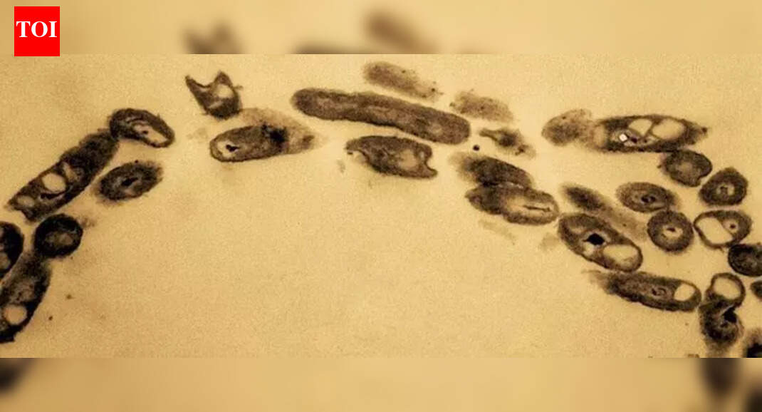 Nacharam petroleum-eating bacterium decoded, to help clean oil-polluted land | Hyderabad News