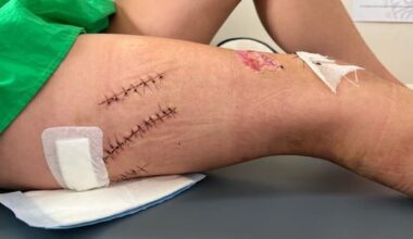 Skipper hits swimmers with propeller after day of drinking