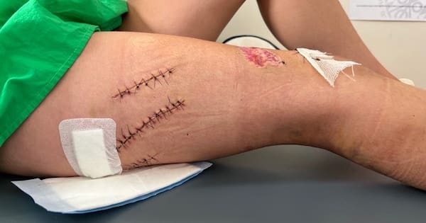 Skipper hits swimmers with propeller after day of drinking