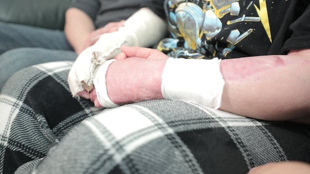 Saskatoon teen admits to lighting classmate on fire in 2024