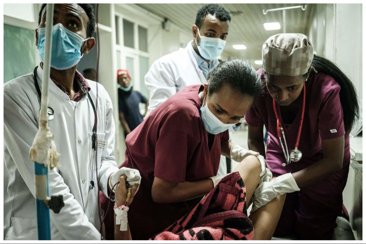 Medical staff give medical care to a young injured resident of Togoga, a village about 20km west of Mekele, at the Ayder referral hospital in Mekele, the capital of Tigray region, Ethiopia on June 23, 2021. (AFP Photo)