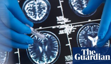 The brain’s five eras, the vaccine that protects against dementia, and altruistic ants – podcast | Science