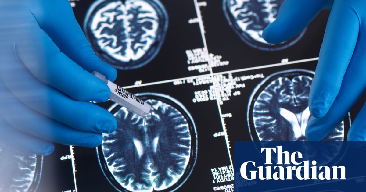 The brain’s five eras, the vaccine that protects against dementia, and altruistic ants – podcast | Science