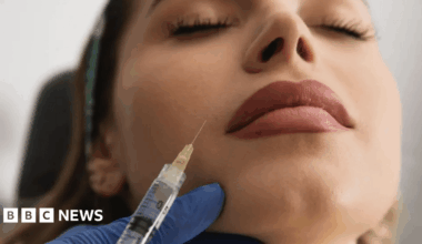Scottish teens as young as 15 seeking help over botched Botox and fillers