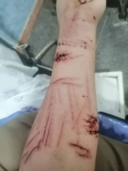 Photo of what appears to be a knife attack during the ceremony of rights lawyer Khosrow Alikordi. 