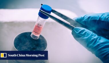 Chinese scientists develop promising stem cell therapy for Parkinson’s disease