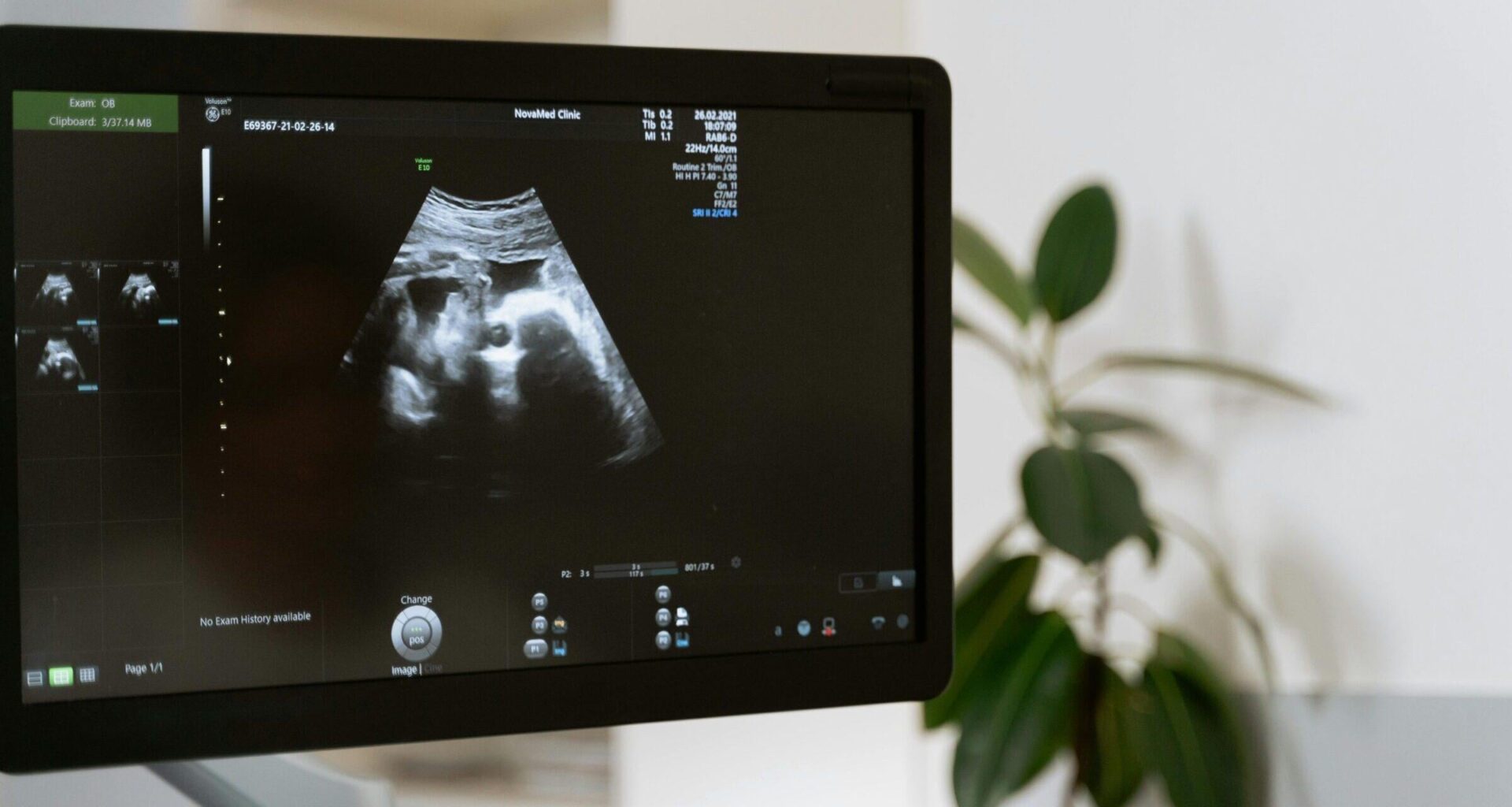 Prosecutors drop case against Polish doctor who performed abortion in ninth month of pregnancy