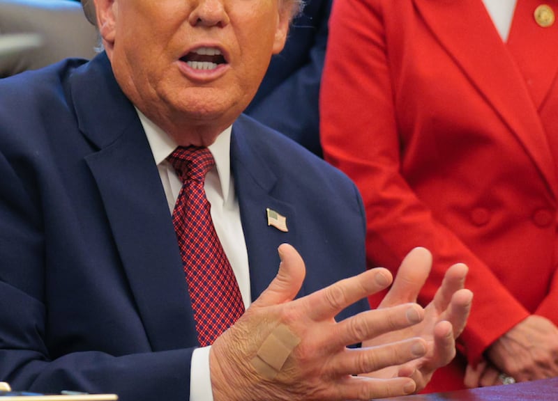 Donald Trump with a Band-Aid on his hand on Wednesday.