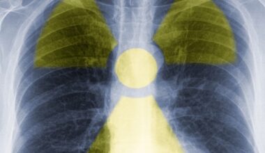 Global nuclear medicine organizations unite to standardize quantitative PET imaging