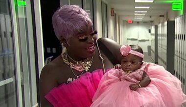 Smallest surviving baby born at Memorial Healthcare has defied the odds – NBC 6 South Florida