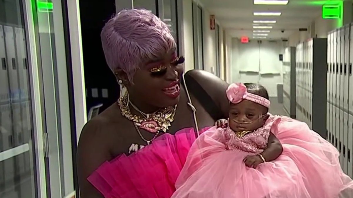 Smallest surviving baby born at Memorial Healthcare has defied the odds – NBC 6 South Florida