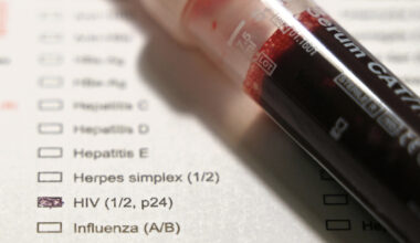 Around 60 cases of HIV assumed to go unnoticed in Luxembourg