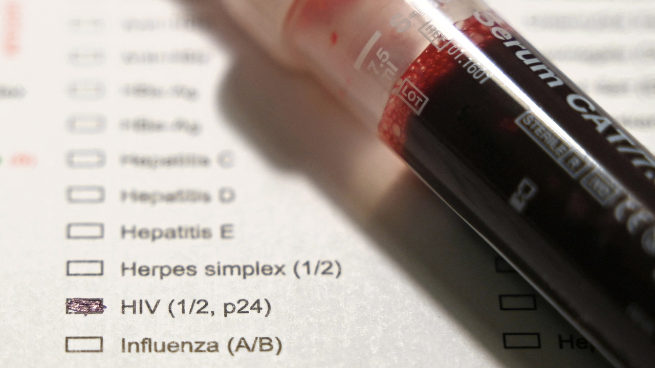 Around 60 cases of HIV assumed to go unnoticed in Luxembourg