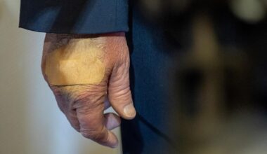 Trump showing signs he’s battling major medical crisis, Democrat claims