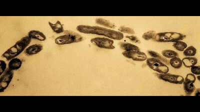 Nacharam petroleum-eating bacterium decoded, to help clean oil-polluted land