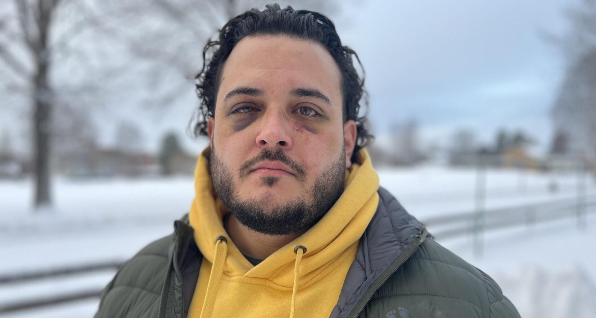 Felix sa ifrån mot rasism – blev slagen och strypt