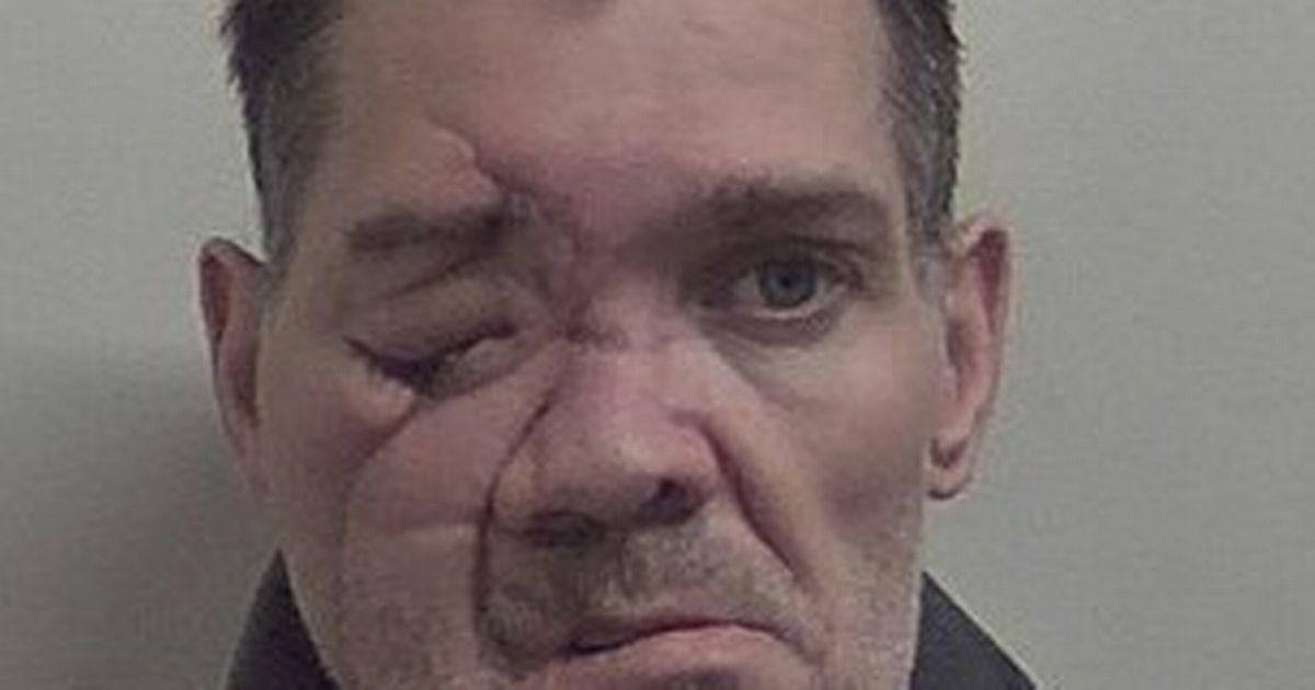 Severely injured burglar 'discharges himself' from hospital to commit more crimes
