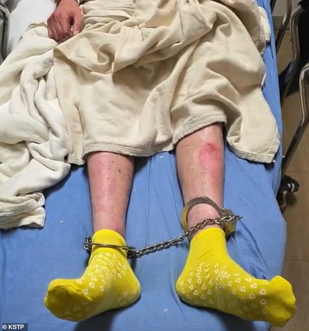 The concern stems from Hani's debilitating genetic condition, Recessive Dystrophic Epidermolysis Bullosa (RDEB), which causes his skin and internal tissues to blister and tear easily (pictured: Hani on a bed with his ankles shackled after detainment)
