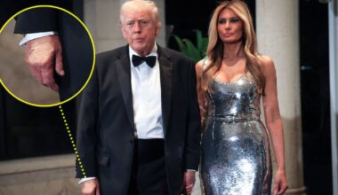 Trump, 79, Rings In The New Year With Makeup-Covered Hand