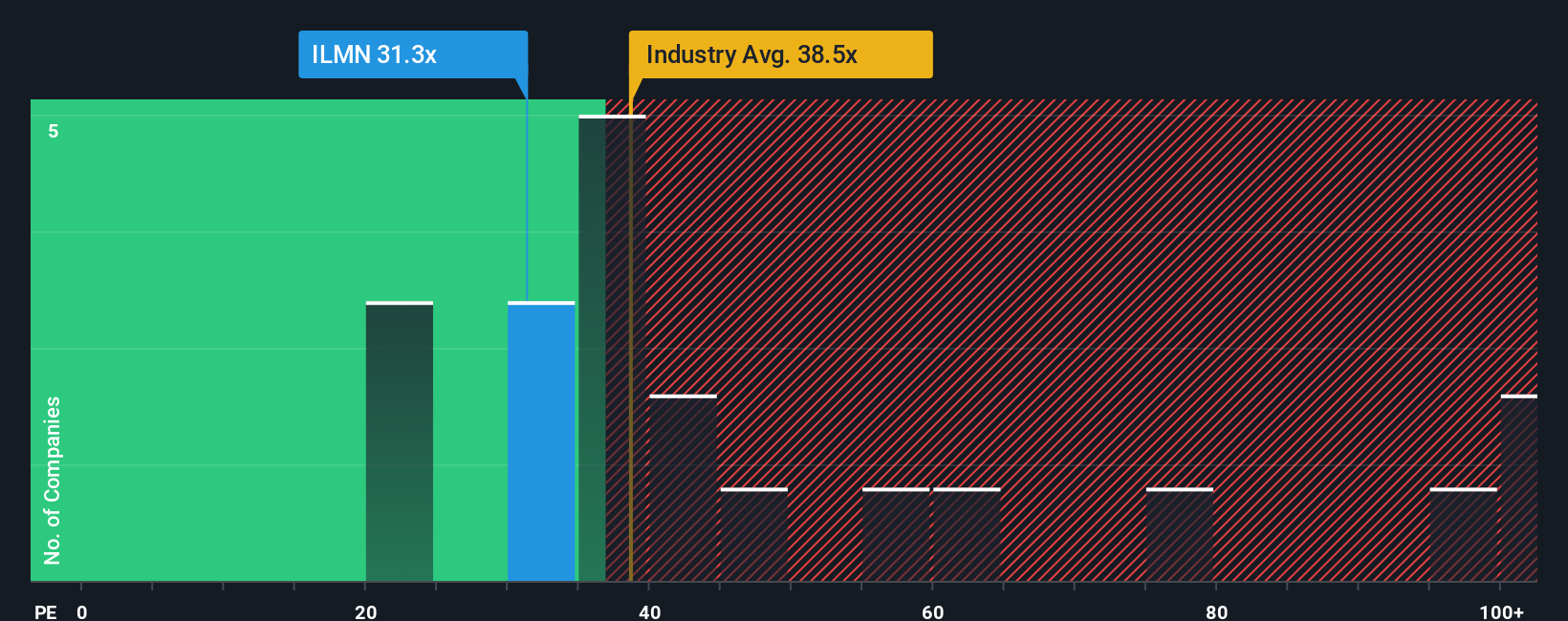 NasdaqGS:ILMN P/E Ratio as at Jan 2026