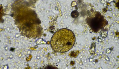 There is a growing public health risk from amoebae tied to climate change