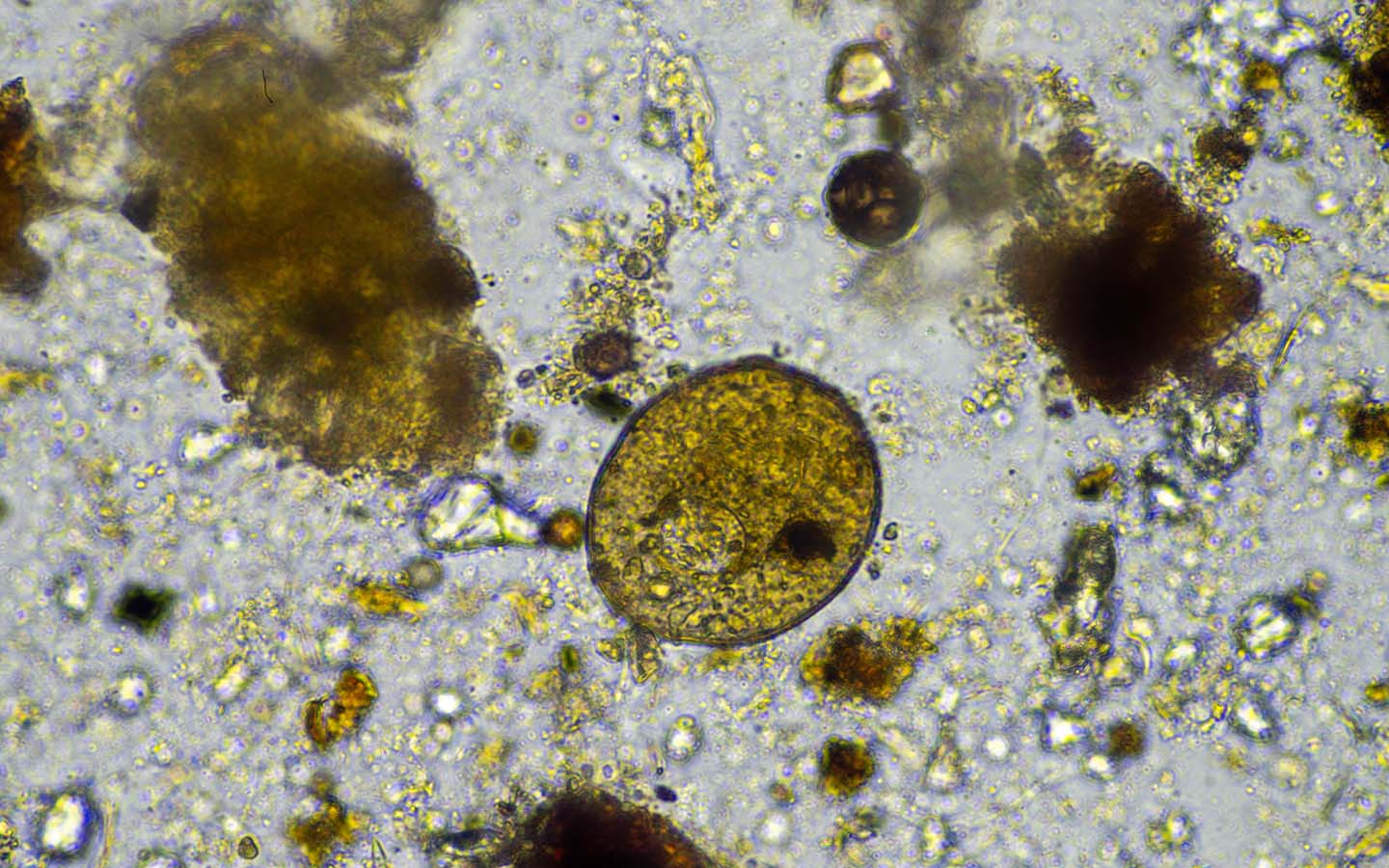 There is a growing public health risk from amoebae tied to climate change