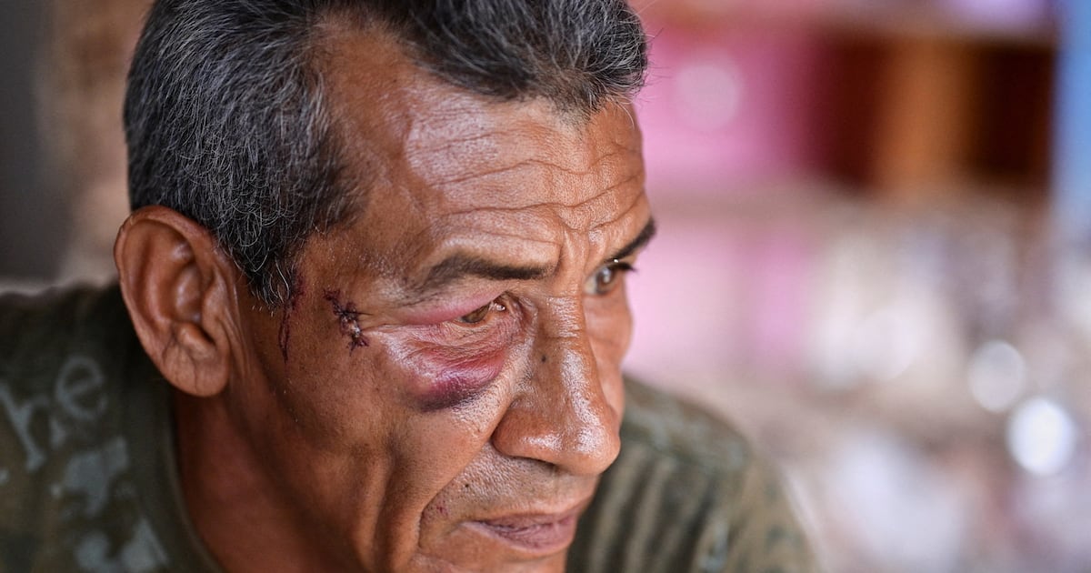 Aftermath of US strikes in Venezuela – The Irish Times