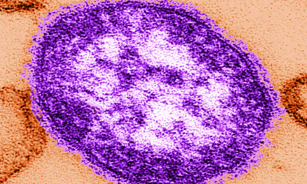 6 European countries, including UK and Spain, lose measles elimination status